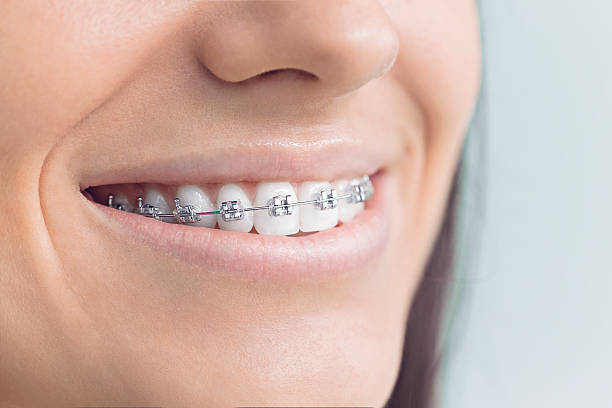 Best Traditional Braces  in Burlington, ND